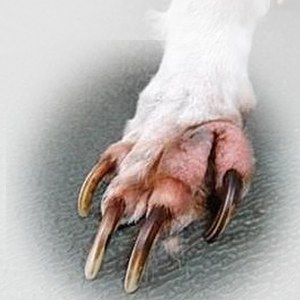 桶状胸型